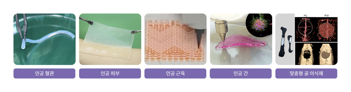 바이오프린팅으로 제작된 인공조직