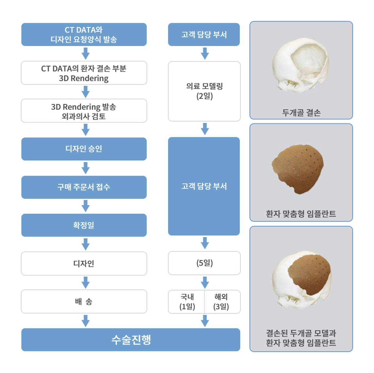 02.jpg 3D 프린터를 이용한 환자맞춤형 의료기기 디자인 소요시간 예시(두개골성형재료)